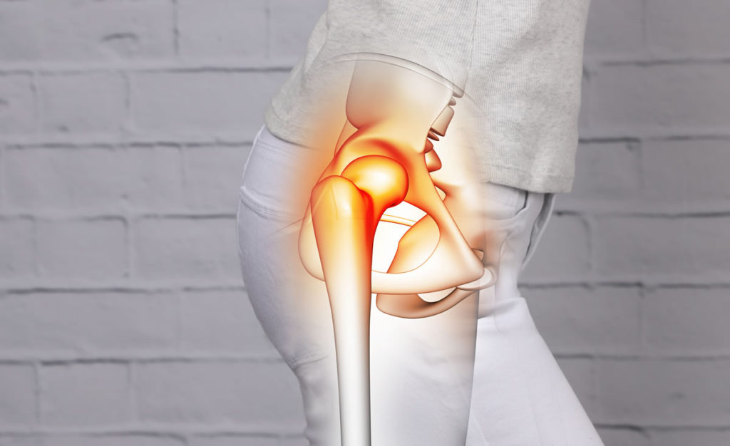 Hip Pain - Recover Physio Hastings